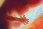 phototake_photo_of_12_week_fetus.jpg