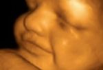 phototake_photo_ultrasound_24_weeks.jpg