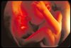 fetal_ultrasound_28_weeks_s10a.jpg