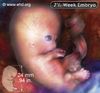 embryoGallery.jpg