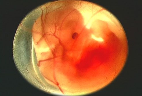 phototake_photo_of_8_week_fetus_circle.jpg