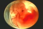 phototake_photo_of_8_week_fetus_circle.jpg
