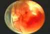 phototake_photo_of_8_week_fetus_circle.jpg