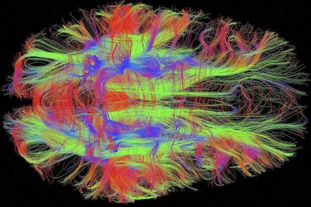brain fiber photo.jpg