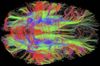 brain fiber photo.jpg