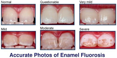 accurate-photos-of-fluorosi[1].jpg