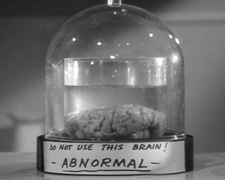 An Abnormal Brain